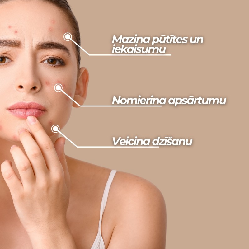 Komplekts Problēmas ādas kopšana