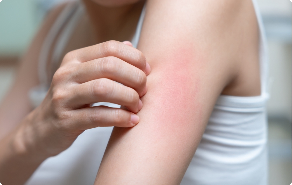 Kā eļļa rētām un pēc kairinājuma